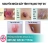 Thịt Dư Thừa Ở Hậu Môn Có Phải Bệnh Sùi Mào Gà Không?