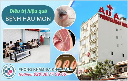 Cách cắt thịt thừa hậu môn an toàn, tiết kiệm, không lo tái phát