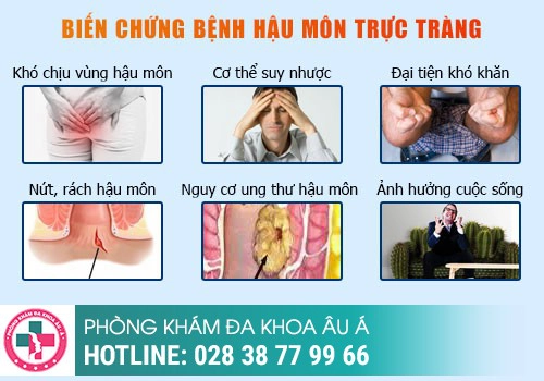 Nếp da thừa hậu môn có nguy hiểm không?