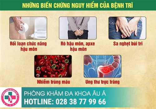 Bệnh Trĩ có nguy hiểm không?