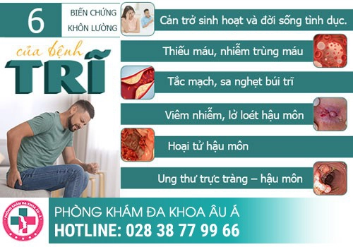 Bệnh trĩ ngứa hậu môn có nguy hiểm không ?