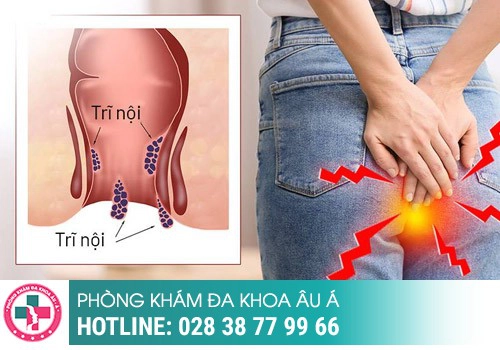 Sau khi cắt trĩ có bị tái phát không?