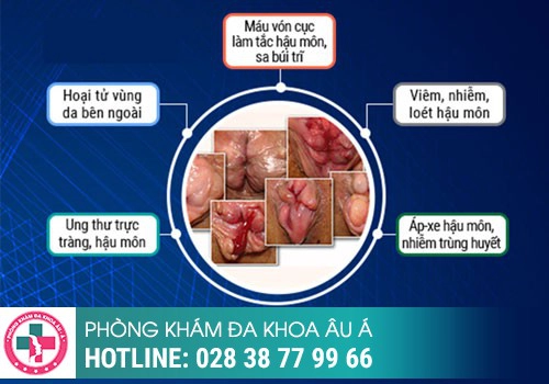 Vì sao bệnh nhân cần phải cắt trĩ?