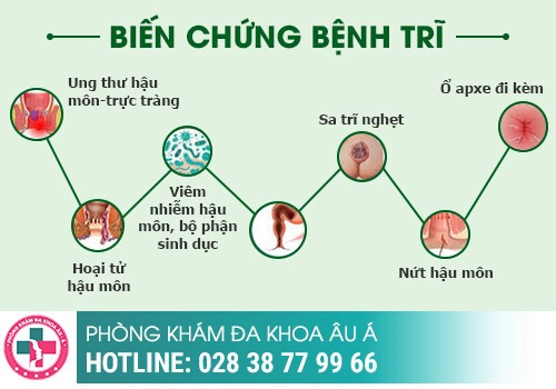 Cắt trĩ nhiều lần có sao không?