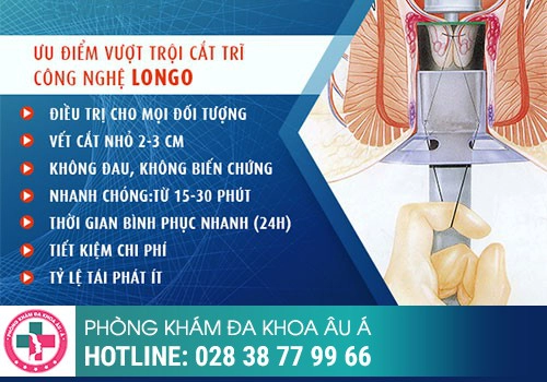 Quy trình phẫu thuật cắt trĩ bằng phương pháp Longo