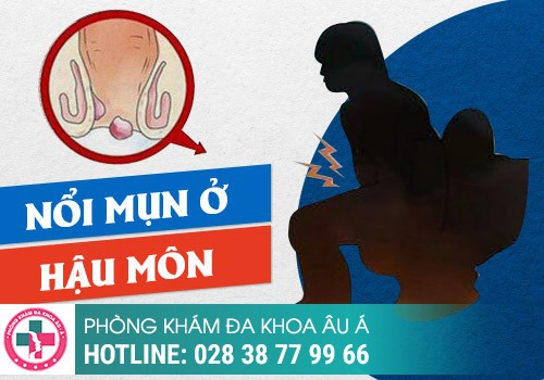 Gần hậu môn có khối u là triệu chứng bệnh gì?