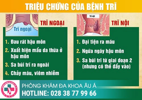 Nguyên nhân gây ngứa hậu môn