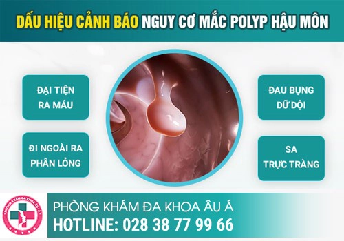 Sưng đau hậu môn là bệnh gì?