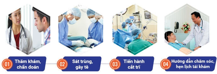 cách điều trị bệnh trĩ