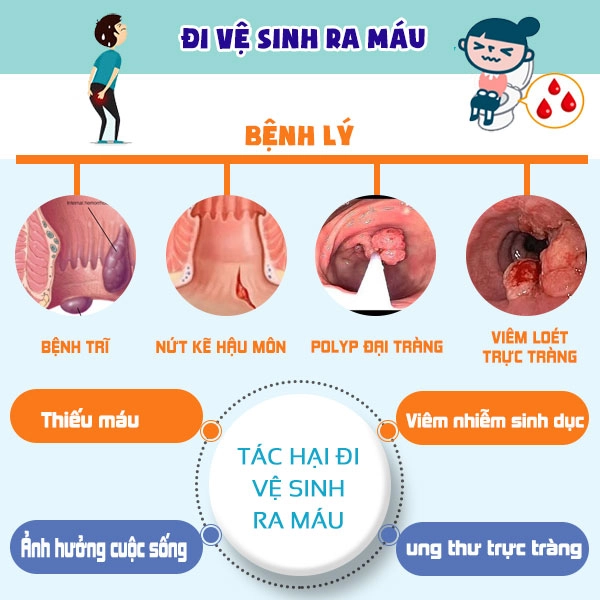 Đi vệ sinh ra máu không nên chủ quan