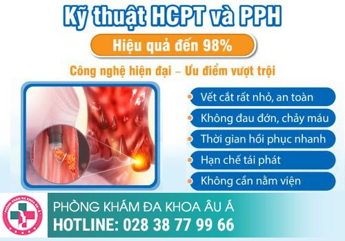 Điều trị trĩ nội độ 3 bằng tây y