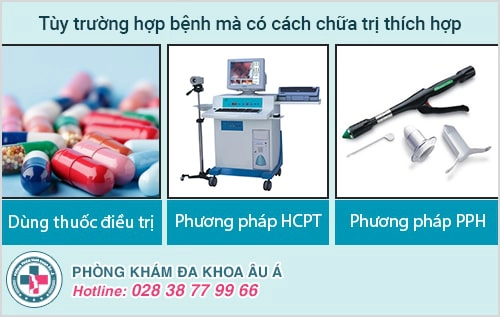 Cách điều trị bệnh trĩ không đau, chi phí rẻ năm 2021