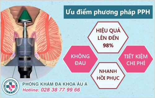 Phương pháp phẫu thuật trĩ hiệu quả nhất hiện nay?