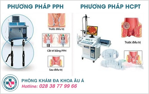 phương pháp pph và hcpt