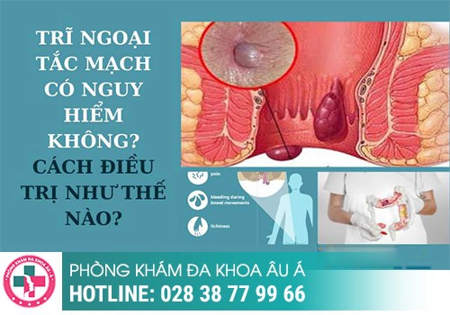 tắc mạch trĩ có nguy hiểm không?