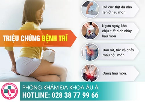 Triệu chứng bệnh trĩ độ 4