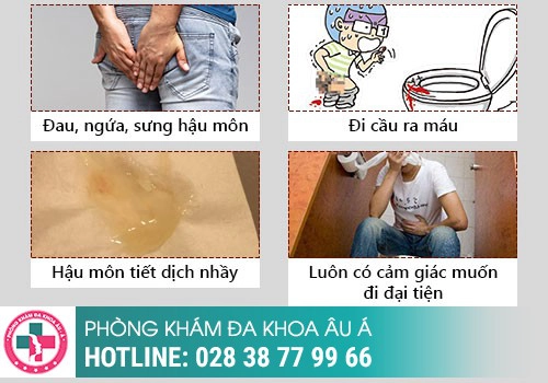 Hậu môn bị sưng ngứa là cảnh báo bệnh gì?