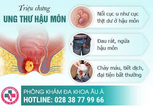 Gần hậu môn có khối u là triệu chứng bệnh gì?