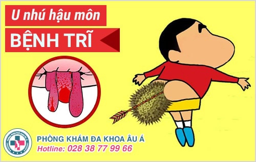 u nhú hậu môn