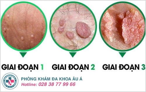 quan hệ tình dục không an toàn