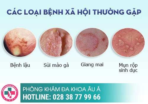 Chẩn đoán bệnh lý qua cách nhận biết hình dạng mụn