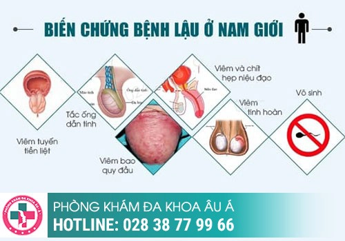 Hối hận khi không thể có con vì trót “đổi gió”, đi khám mới biết mắc bệnh lậu ở nam