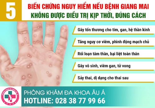 Bệnh giang mai là gì?