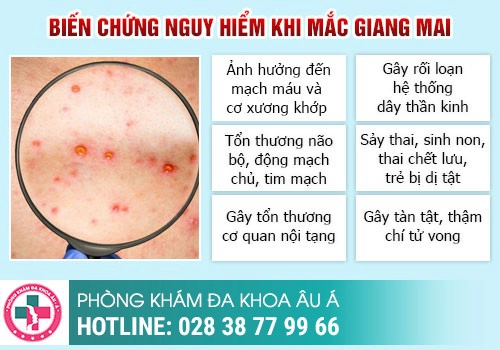 Ảnh hưởng của bệnh giang mai đến sức khỏe
