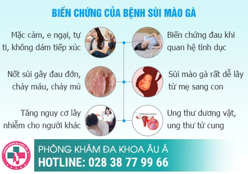 SÙI MÀO GÀ CÓ NGUY HIỂM KHÔNG?