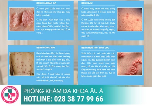 Những bệnh xã hội ở nam giới thường gặp