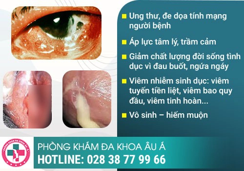 Bệnh lậu là bệnh gì, có nguy hiểm không?