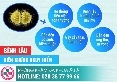 triệu chứng bệnh kim la