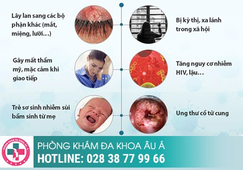 Sùi mào gà ở nữ giai đoạn đầu có tự khỏi được không?