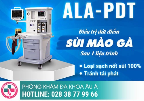 Phương pháp chữa sùi mào gà tại Phòng Khám Đa Khoa Âu Á