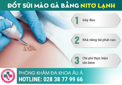 Các phương pháp điều trị sùi mào gà hiệu quả nhất