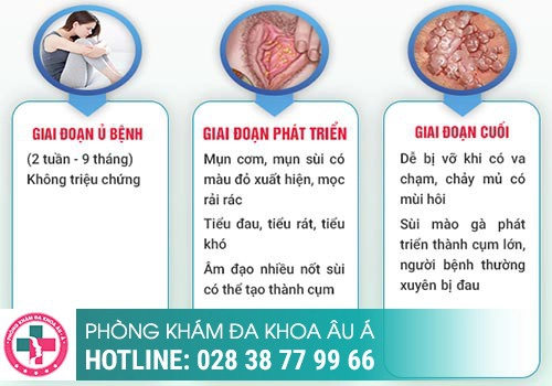 Triệu chứng bệnh sùi mào gà ở nữ giai đoạn đầu