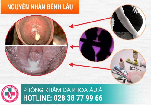 Các nguyên nhân chính gây ra bệnh lậu 