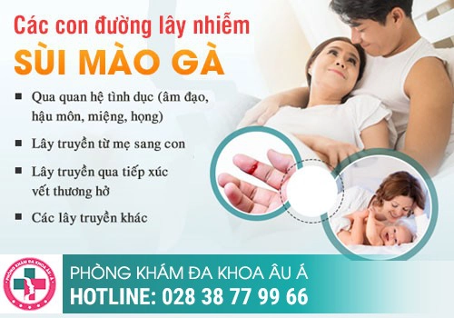 CHỈ MỘT LẦN “ĐỔI GIÓ” VỚI GÁI MẠI DÂM ĐÃ MẮC SÙI MÀO GÀ