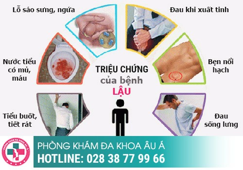 Hối hận khi không thể có con vì trót “đổi gió”, đi khám mới biết mắc bệnh lậu ở nam