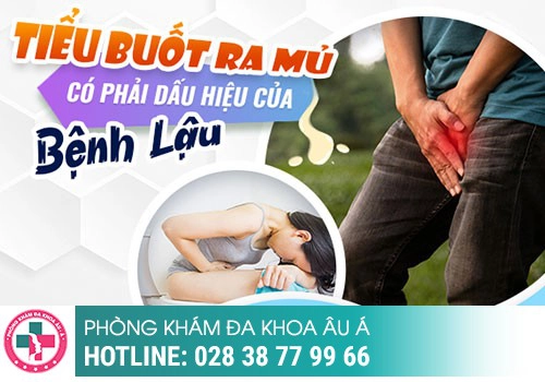 Tiểu buốt có phải dấu hiệu của bệnh lậu không?