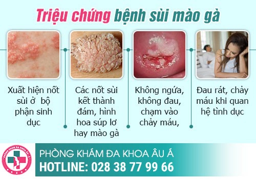 Hậu môn nổi thịt và ngứa là dấu hiệu bệnh gì?