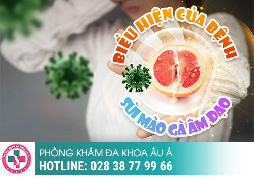 Hình ảnh sùi mào gà ở âm đạo