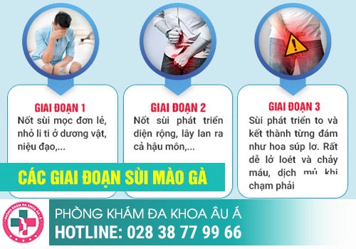 Chữa bệnh sùi mào gà ở đâu tốt nhất tại tp hcm?