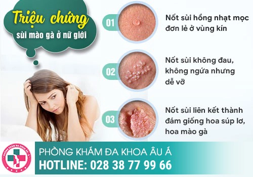 hình ảnh sùi mào gà