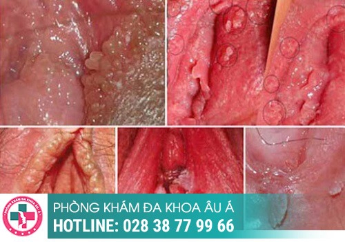 bệnh viện bệnh xã hội
