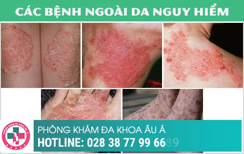 Phòng khám da liễu điều trị bệnh xã hội