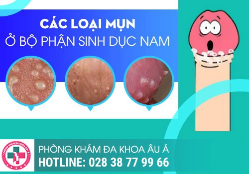 Mọc mụn ở đầu có nguy hiểm không?