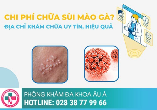 Chi phí chữa bệnh sùi mào gà có đắt không?