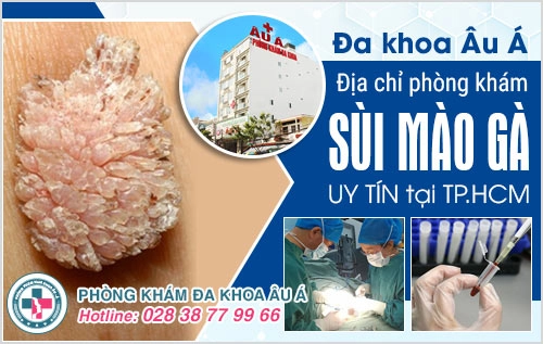 phòng khám sùi mào gà