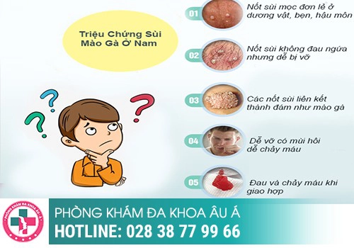 Nổi hạch dương vật là dấu hiệu bệnh gì?